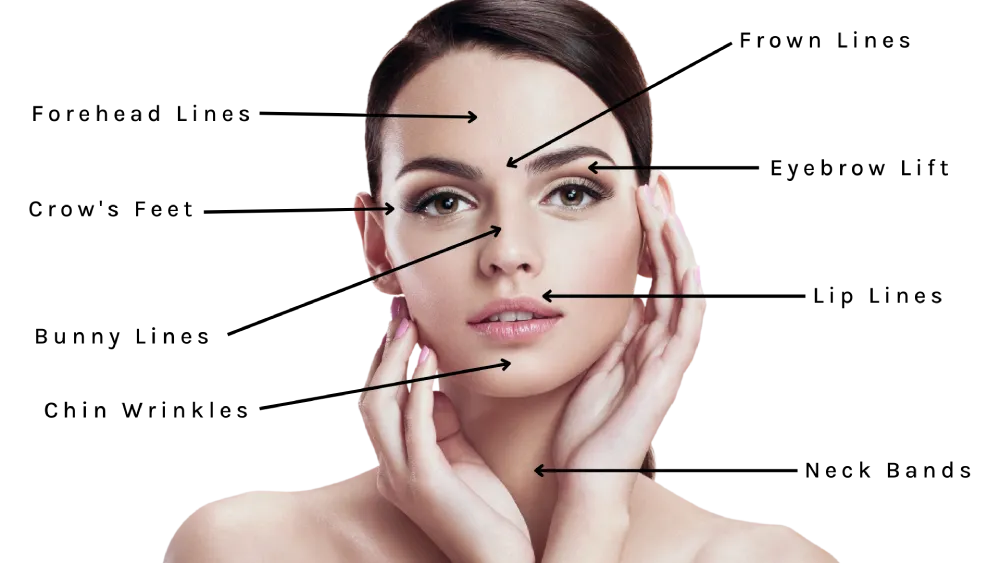 Botox Treatment Areas on Young Women's Face | Kor Medspa in Wyomissing, PA