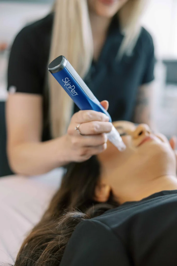 Woman receiving skinpen microneedling treatment