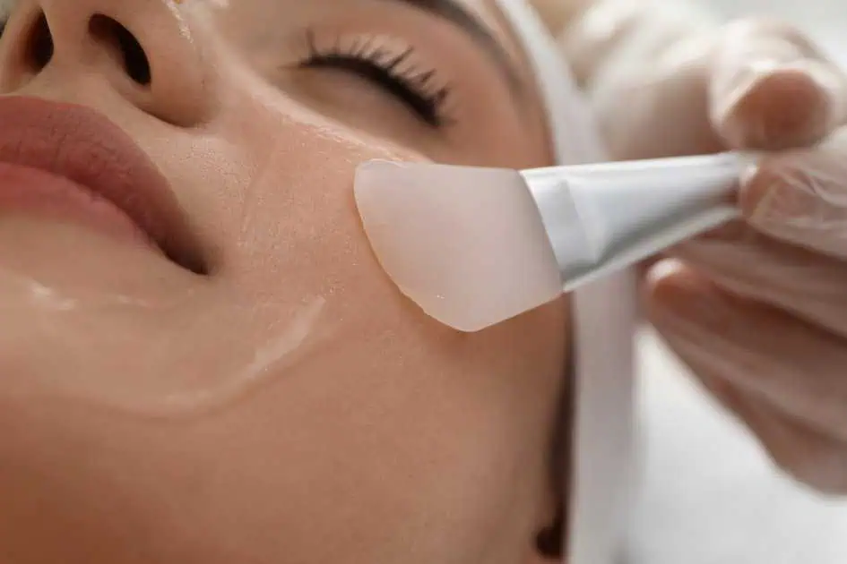 Chemical Peels in Wyomissing PA by Kor Medspa