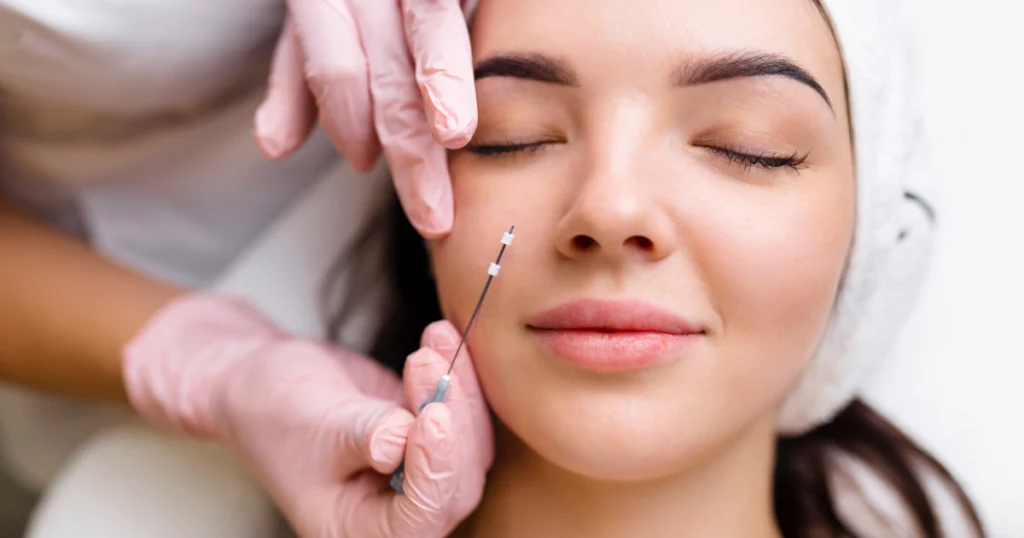 PDO threads lift facial treatment for skin tightening in Wyomissing, PA clinic