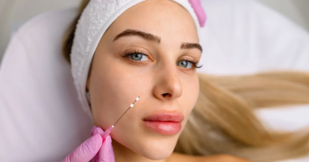 Close-up of a young woman with a white headband receiving a PDO thread lift near her nose and upper lip in Wyomissing, PA
